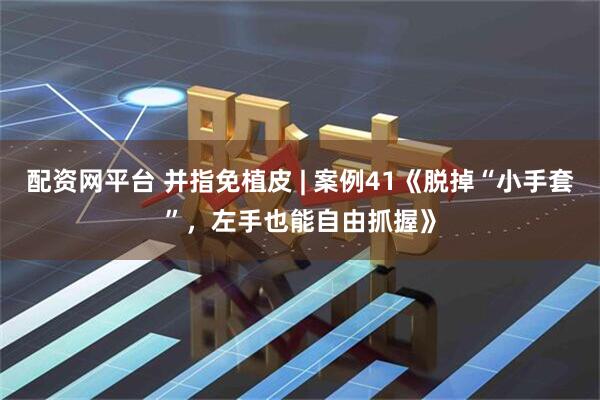 配资网平台 并指免植皮 | 案例41《脱掉“小手套”，左手也能自由抓握》
